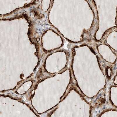 Immunohistochemistry-Paraffin: CKI gamma 3 Antibody [NBP1-91045] - Staining of human thyroid gland shows strong cytoplasmic positivity in glandular cells.