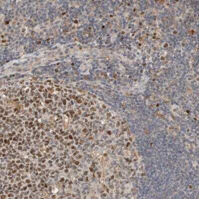 Immunohistochemistry-Paraffin: CKI gamma 3 Antibody [NBP1-91045] - Staining of human tonsil shows nuclear and cytoplasmic positivity in both germinal center and non-germinal center cells.