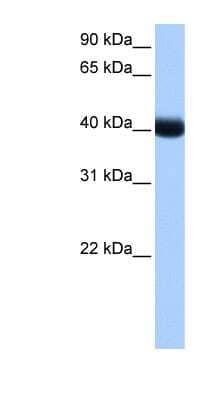 Western Blot: CKI gamma 3 Antibody [NBP1-57573] - Human Liver cell lysate, concentration 0.2-1 ug/ml.