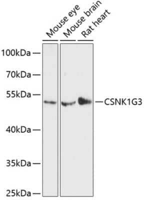 Western Blot: CKI gamma 3 Antibody [NBP2-92102] - Analysis of extracts of various cell lines, using CKI gamma 3 at 1:3000 dilution.Secondary antibody: HRP Goat Anti-Rabbit IgG (H+L) at 1:10000 dilution.Lysates/proteins: 25ug per lane.Blocking buffer: 3% nonfat dry milk in TBST.Detection: ECL Basic Kit .Exposure time: 90s.