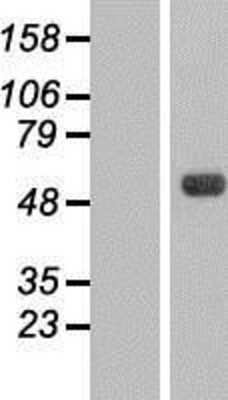 Western Blot: CKI gamma 3 Overexpression Lysate (Adult Normal) [NBL1-09535] Left-Empty vector transfected control cell lysate (HEK293 cell lysate); Right -Over-expression Lysate for CKI gamma 3.