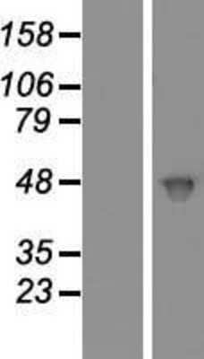 Western Blot Casein Kinase 2 alpha Overexpression Lysate