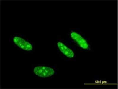 Immunocytochemistry/Immunofluorescence: CKII alpha prime polypeptide Antibody (4F2) [H00001459-M01] - Analysis of monoclonal antibody to CSNK2A2 on HeLa cell . Antibody concentration 10 ug/ml.