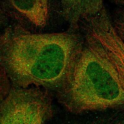 Immunocytochemistry/Immunofluorescence: CKII alpha prime polypeptide Antibody [NBP2-57977] - Staining of human cell line U-2 OS shows localization to nucleoplasm, cytosol & vesicles.