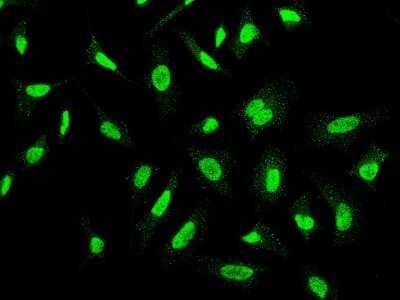 Immunocytochemistry/Immunofluorescence: CKII alpha prime polypeptide Antibody [NBP2-99686] - Immunofluorescence staining of CKII alpha prime polypeptide in HeLa cells. Cells were fixed with 4% PFA, permeabilzed with 0.3% Triton X-100 in PBS, blocked with 10% serum, and incubated with rabbit anti-human CKII alpha prime polypeptide polyclonal antibody (1:1000) at 4C overnight. Then cells were stained with the Alexa Fluor(R)488-conjugated Goat Anti-rabbit IgG secondary antibody (green).Positive staining was localized to cytoplasm and nucleus.