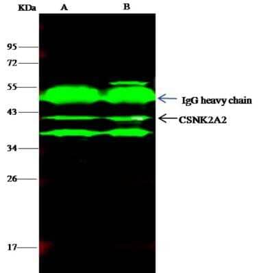 Immunoprecipitation: CKII alpha prime polypeptide Antibody [NBP2-99686] - CKII alpha prime polypeptide was immunoprecipitated using: Lane A: 0.5 mg Jurkat Whole Cell Lysate. Lane B: 0.5 mg HepG2 Whole Cell Lysate4 ul anti-CKII alpha prime polypeptide rabbit polyclonal antibody and 15 ul of 50 % Protein G agarose. Primary antibody: Anti-CKII alpha prime polypeptide rabbit polyclonal antibody, at 1:100 dilution. Secondary antibody: Dylight 800-labeled antibody to rabbit IgG (H+L), at 1:5000 dilution. Developed using the Odyssey technique. Performed under reducing conditions. Predicted band size: 41 kDa. Observed band size: 41 kDa