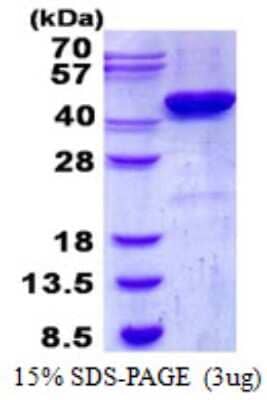SDS-PAGE Recombinant Human CKII alpha prime polypeptide His Protein