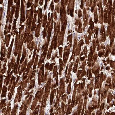 Immunohistochemistry-Paraffin CKMT2 Antibody