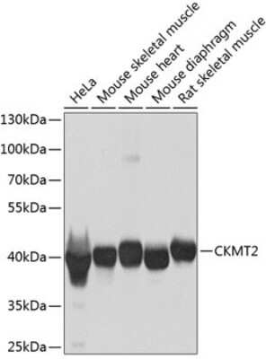 Western Blot: CKMT2 Antibody [NBP2-92825] - Analysis of extracts of various cell lines, using CKMT2 at 1:1000 dilution.Secondary antibody: HRP Goat Anti-Rabbit IgG (H+L) at 1:10000 dilution.Lysates/proteins: 25ug per lane.Blocking buffer: 3% nonfat dry milk in TBST.Detection: ECL Basic Kit .Exposure time: 1s.