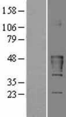 Western Blot: CKMT2 Overexpression Lysate (Adult Normal) [NBP2-08295] Left-Empty vector transfected control cell lysate (HEK293 cell lysate); Right -Over-expression Lysate for CKMT2.