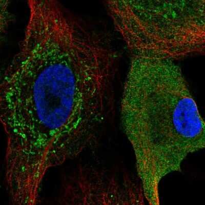 Immunocytochemistry/Immunofluorescence: CKS2 Antibody [NBP2-58720] - Staining of human cell line A549 shows localization to cytosol & mitochondria.