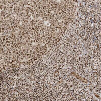 Immunohistochemistry-Paraffin: CKS2 Antibody [NBP1-86336] - Staining of human tonsil shows strong nuclear positivity in germinal center cells and non-germinal center cells.