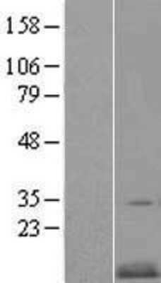 Western Blot: CKS2 Overexpression Lysate (Adult Normal) [NBL1-09225] Left-Empty vector transfected control cell lysate (HEK293 cell lysate); Right -Over-expression Lysate for CKS2.