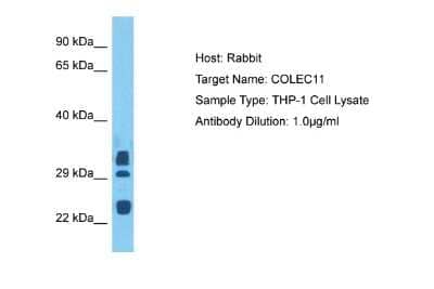 Western Blot: CL-K1/COLEC11 Antibody [NBP2-82698] - Host: Rabbit. Target Name: COLEC11. Sample Tissue: Human THP-1 Whole Cell. Antibody Dilution: 3ug/ml