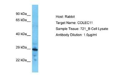 Western Blot: CL-K1/COLEC11 Antibody [NBP2-82705] - Host: Rabbit. Target Name: COLEC11. Sample Type: 721_B Whole Cell lysates. Antibody Dilution: 1.0ug/ml