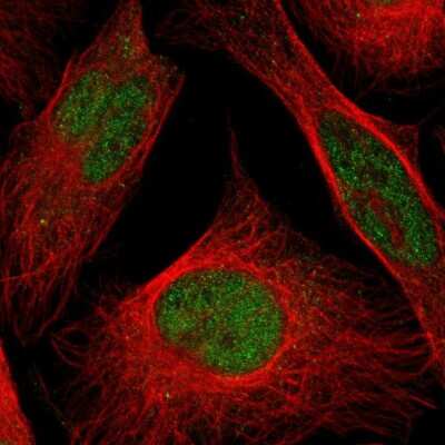 Immunocytochemistry/ Immunofluorescence CLP1/HEAB Antibody - BSA Free