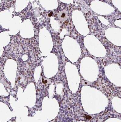 Immunohistochemistry-Paraffin CLP1/HEAB Antibody - BSA Free