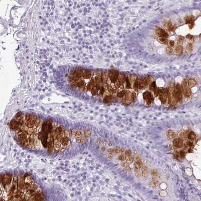 Immunohistochemistry: CLCA1 Antibody [NBP2-49060] - Staining of human colon shows strong cytoplasmic positivity in glandular cells.