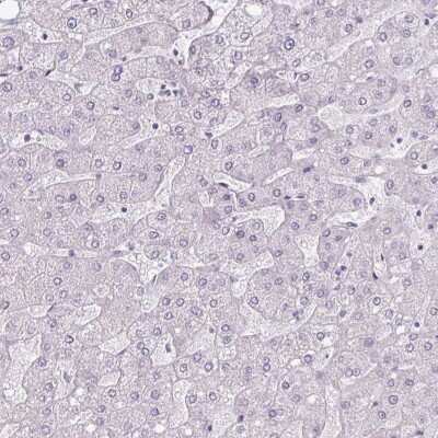 Immunohistochemistry-Paraffin: CLCA1 Antibody [NBP2-49060] - Staining of human liver shows low expression as expected.