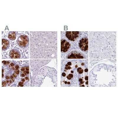 <b>Independent Antibodies Validation. </b>Immunohistochemistry-Paraffin: CLCA1 Antibody [NBP2-49060] - Staining of human colon, liver, small intestine and testis using Anti-CLCA1 antibody NBP2-49060 (A) shows similar protein distribution across tissues to independent antibody NBP2-38869 (B).