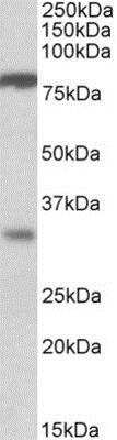 Western Blot: CLCA1 Antibody [NB100-1791] (1ug/ml) staining of Human Duodenum lysate (35ug protein in RIPA buffer). Primary incubation was 1 hour. Detected by chemiluminescence.