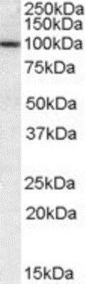 Western Blot: CLCA1 Antibody [NBP1-05038] - Analysis of CLCA1 in Human Lung lysate at 0.3ug/ml (35ug protein in RIPA buffer). Primary incubation was 1 hour. Detected by chemiluminescence.