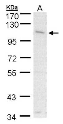 Western Blot: CLCA1 Antibody [NBP1-31129] - (30 ug of whole cell lysate) A431 7. 5% SDS PAGE, antibody diluted at 1:1000.