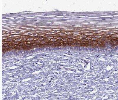 Immunohistochemistry-Paraffin: CLCA2 Antibody [NBP2-33482] - Staining of human cervix, uterine shows strong membranous positivity in squamous epithelial cells.