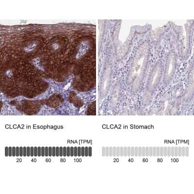 Immunohistochemistry-Paraffin: CLCA2 Antibody [NBP2-33482] - Analysis in human esophagus and stomach tissues. Corresponding CLCA2 RNA-seq data are presented for the same tissues.