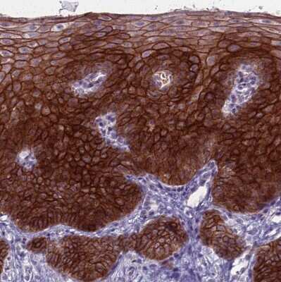 Immunohistochemistry-Paraffin: CLCA2 Antibody [NBP2-33482] - Staining of human esophagus shows strong membranous positivity in squamous epithelial cells.