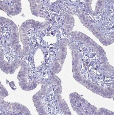 Immunohistochemistry-Paraffin: CLCA2 Antibody [NBP2-33482] - Staining of human Fallopian tube shows no positivity in glandular cells as expected.