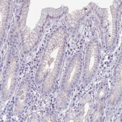Immunohistochemistry-Paraffin: CLCA2 Antibody [NBP2-33482] - Staining of human stomach shows no positivity in glandular cells as expected.