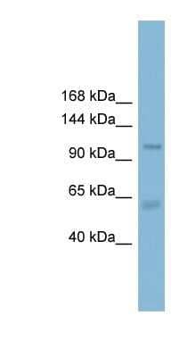 Western Blot: CLCA2 Antibody [NBP1-80071] - THP-1 cell lysate, concentration 0.2-1 ug/ml.