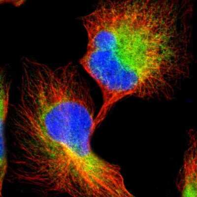 <b>Independent Antibodies Validation. </b>Immunocytochemistry/Immunofluorescence: CLCC1 Antibody [NBP1-82793] - Staining of human cell line U-251 MG shows localization to endoplasmic reticulum. Antibody staining is shown in green.