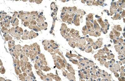 Immunohistochemistry-Paraffin: CLCC1 Antibody [NBP1-59834] - Human Muscle Tissue, Skeletal muscle cells (Indicated with Arrows) 4-8ug/ml.