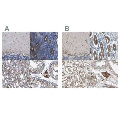 Immunohistochemistry-Paraffin CLCC1 Antibody - BSA Free