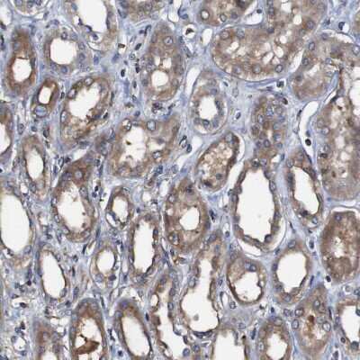 Immunohistochemistry-Paraffin: CLCC1 Antibody [NBP1-82792] - Staining of human kidney shows moderate cytoplasmic positivity in cells in tubules.