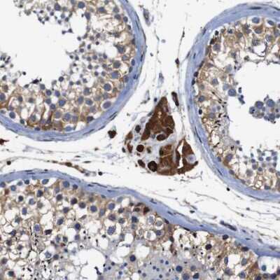 Immunohistochemistry-Paraffin: CLCC1 Antibody [NBP1-82792] - Staining of human testis shows strong cytoplasmic positivity in Leydig cells.
