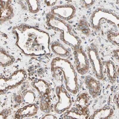 Immunohistochemistry-Paraffin: CLCC1 Antibody [NBP1-82793] - Staining of human kidney shows moderate cytoplasmic positivity in cells in tubules.