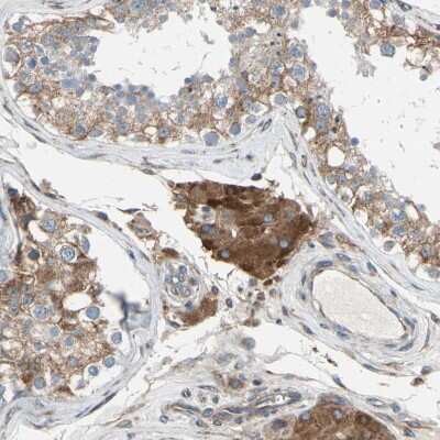 Immunohistochemistry-Paraffin: CLCC1 Antibody [NBP1-82793] - Staining of human testis shows moderate cytoplasmic positivity in Leydig cells.