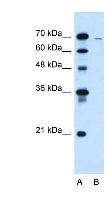 Western Blot: CLCC1 Antibody [NBP1-59834] - HepG2 cell lysate, Antibody Titration: 1.25ug/ml