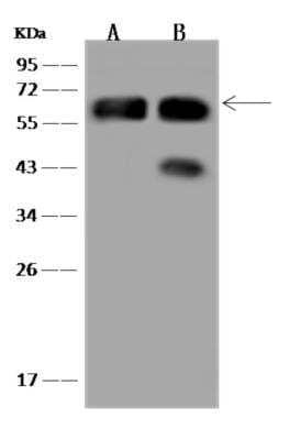 Western Blot: CLCC1 Antibody [NBP3-06071] - Anti-CLCC1 rabbit polyclonal antibody at 1:500 dilution Lane A: HT29 Whole Cell Lysate Lane B: U-251 MG Whole Cell Lysate Lysates/proteins at 30 ug per lane.Secondary: Goat Anti-Rabbit IgG (H+L)HRP  at 110000 dilution. Developed using the ECL technique. Performed under reducing conditions. Predicted band size:62 kDa Observed band size:62 kDa (We are unsure as to the identity of these extra bands.)