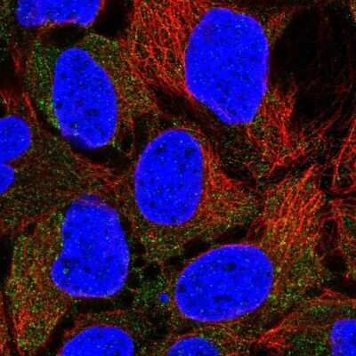 Immunocytochemistry/Immunofluorescence: CLCN2 Antibody [NBP1-85585] - Staining of human cell line CACO-2 shows localization to cytosol. Antibody staining is shown in green.