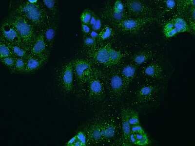 Immunocytochemistry/Immunofluorescence: CLCN2 Antibody [NBP2-97349] - Immunofluorescence staining of CLCN2 in CACO2 cells. Cells were fixed with 4% PFA, permeabilzed with 0.1% Triton X-100 in PBS, blocked with 10% serum, and incubated with rabbit anti-Human CLCN2 polyclonal antibody (dilution ratio 1:200) at 4C overnight. Then cells were stained with the Alexa Fluor(R)488-conjugated Goat Anti-rabbit IgG secondary antibody (green) and counterstained with DAPI (blue).Positive staining was localized to Cytoplasm.