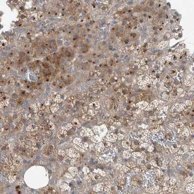 Immunohistochemistry-Paraffin: CLCN2 Antibody [NBP1-85584] - Staining of human adrenal gland shows moderate granular cytoplasmic  positivity in glandular cells.