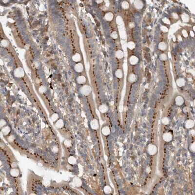 Immunohistochemistry-Paraffin: CLCN2 Antibody [NBP1-85584] - Staining of human duodenum shows moderate granular cytoplasmic positivity in glandular cells.