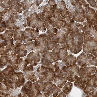 Immunohistochemistry-Paraffin: CLCN2 Antibody [NBP1-85584] - Staining of human pancreas shows strong cytoplasmic positivity in exocrine glandular cells.