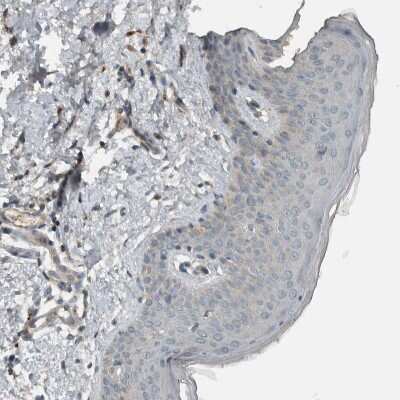 Immunohistochemistry-Paraffin: CLCN2 Antibody [NBP1-85584] - Staining of human skin shows very weak positivity in squamous epithelial cells as expected.