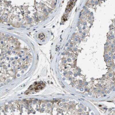 Immunohistochemistry-Paraffin: CLCN2 Antibody [NBP1-85585] - Staining of human testis shows strong cytoplasmic positivity in Leydig cells.