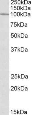 Western Blot: CLCN2 Antibody [NBP1-52032] - Analysis of CLCN2 in HeLa lysate (35ug protein in RIPA buffer) using this antibody at 0.3 ug/ml. Primary incubation was 1 hour. Detected by chemiluminescence.